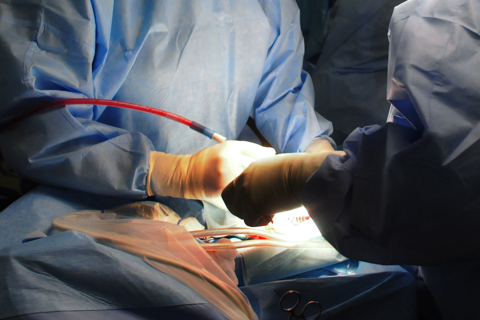 Chirurgia pancreas, alta mortalit in 300 centri, evitabili 130 decessi annui