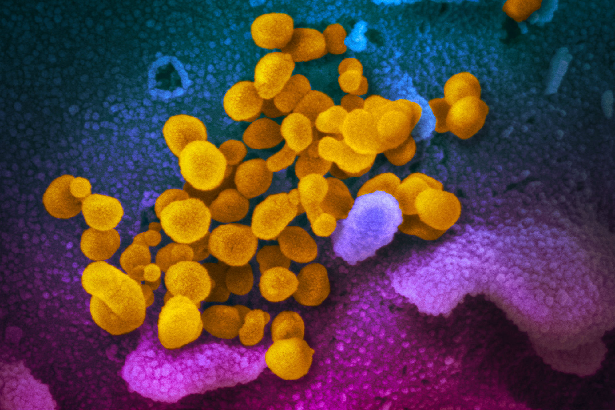 Coronavirus, dagli Usa il primo ritratto in 5 foto a colori
