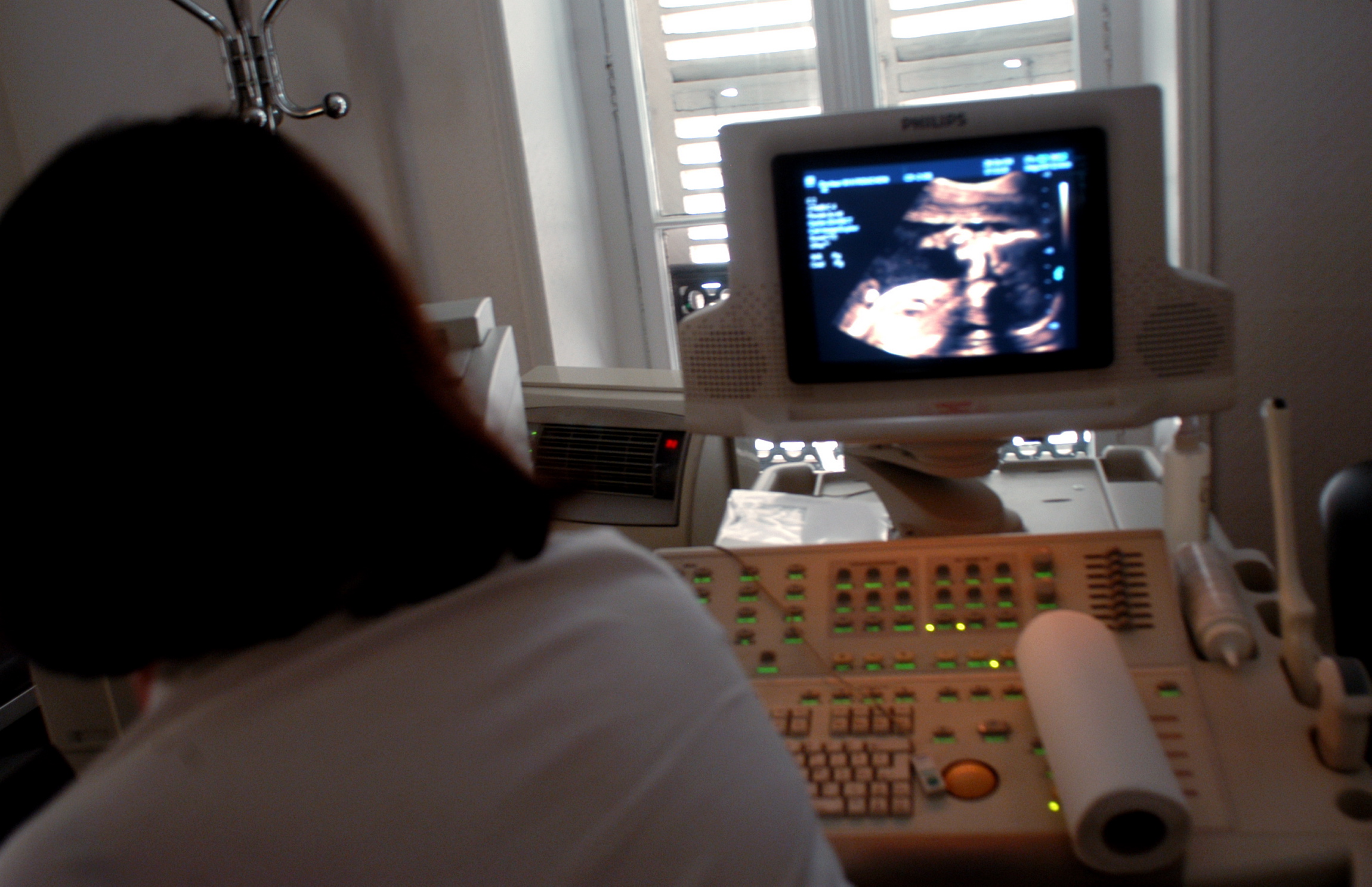 Aborto, 22 ospedali con 100% obiettori tra operatori