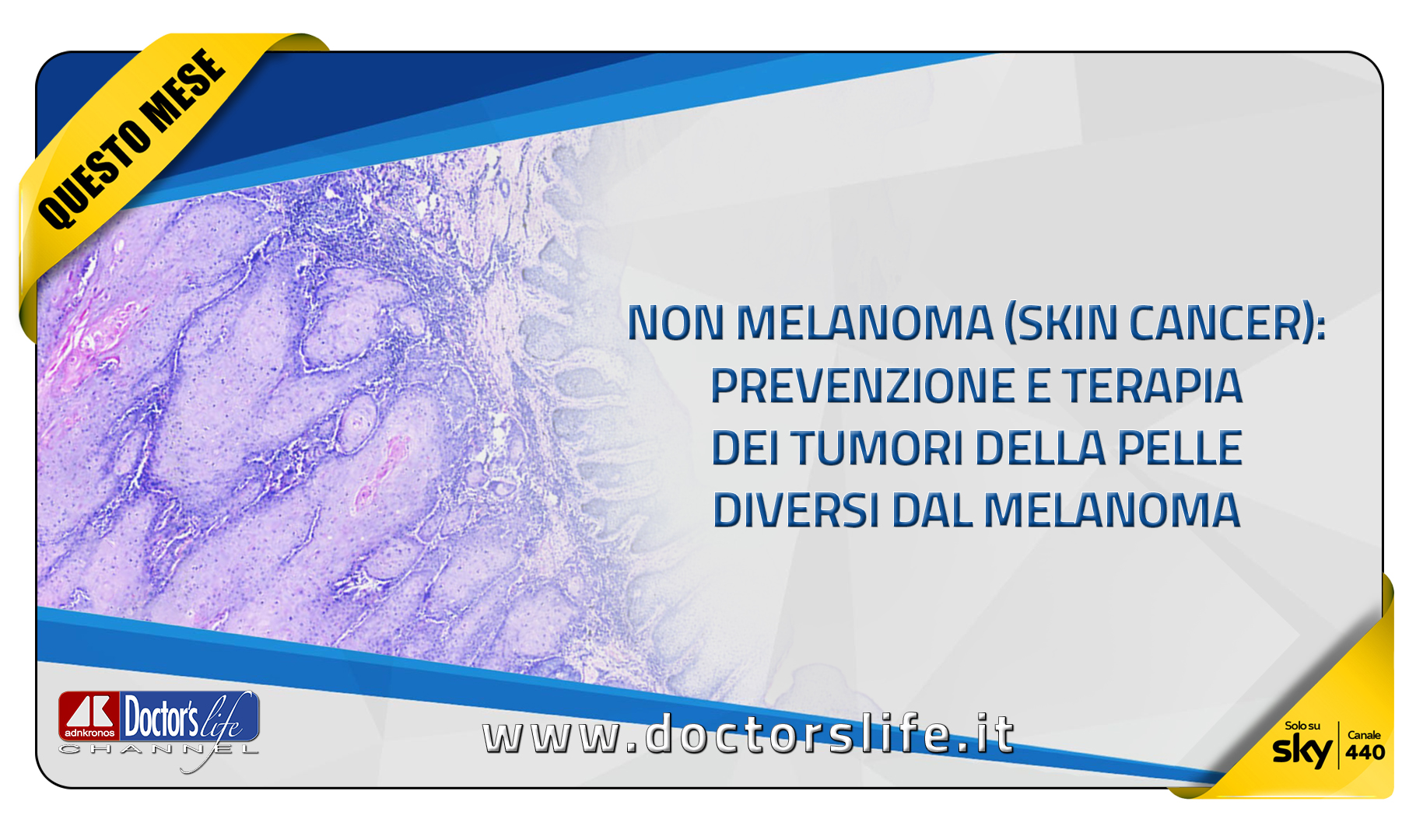 Non melanoma (skin cancer): prevenzione e terapia dei tumori della pelle diversi dal melanoma