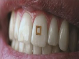 Il sensore si attacca al dente e 'spia' quello che mangi e bevi