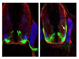 Scoperto il gene 'bussola' che guida lo sviluppo dei neuroni