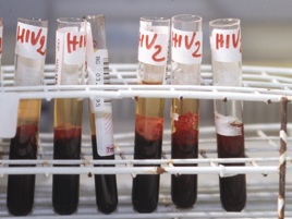 Studio Cns, praticamente azzerato rischio infezioni da trasfusione
